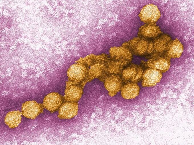 West-Nil-Virus