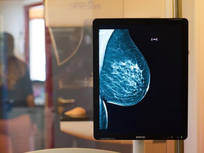 Röntgenaufnahme der Brust einer Frau