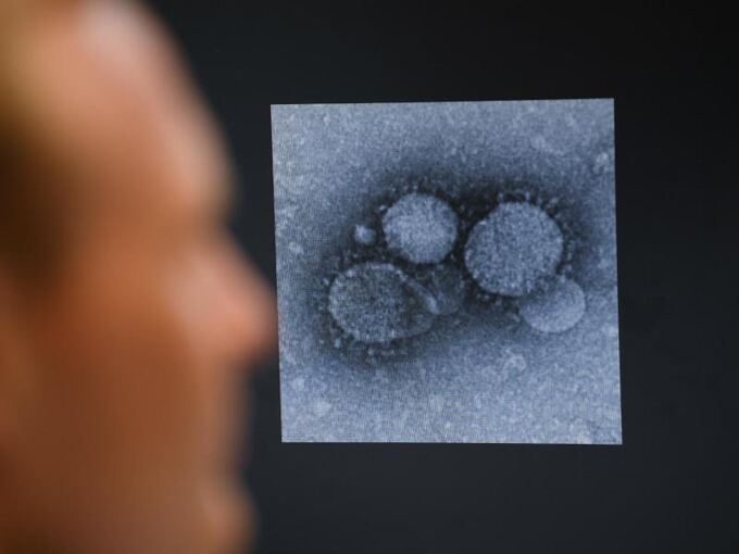 Ein Virologe betrachtet den MERS-Coronavirus