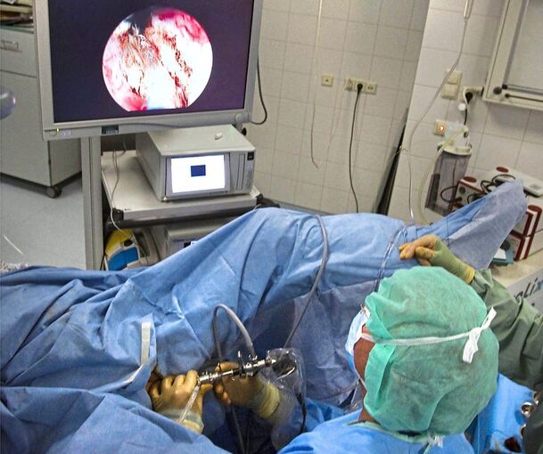 Ein Ludwigsburger Mediziner setzt bei einer Operation Kamera und Laser ein: Kreisklinikenchef Jörg Martin plant, seinen Krankenhauskonzern weiter auszubauen. Foto: Holm Wolschendorf