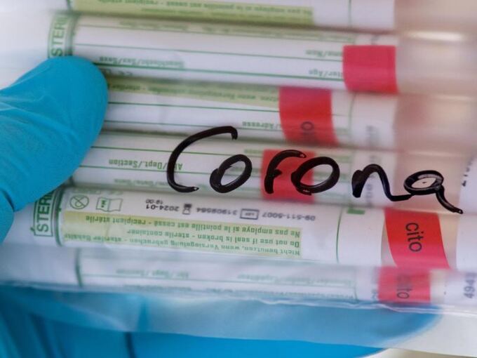 Proben für Corona-Tests werden untersucht