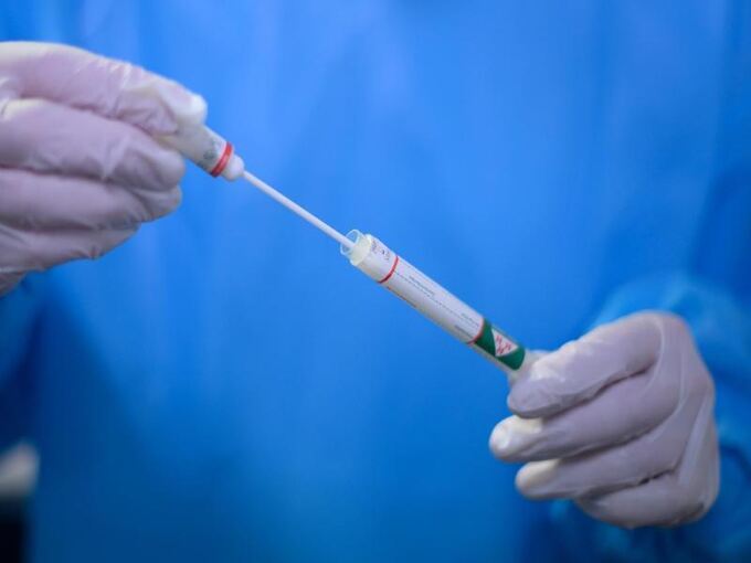 Ein Arzt hält einen Coronavirus-Test in den Händen
