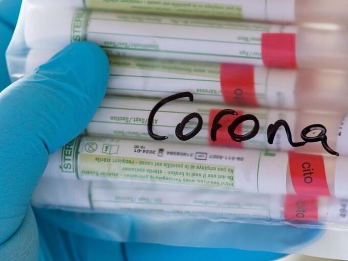 Proben für Corona-Tests werden in einem Labor vorbereitet