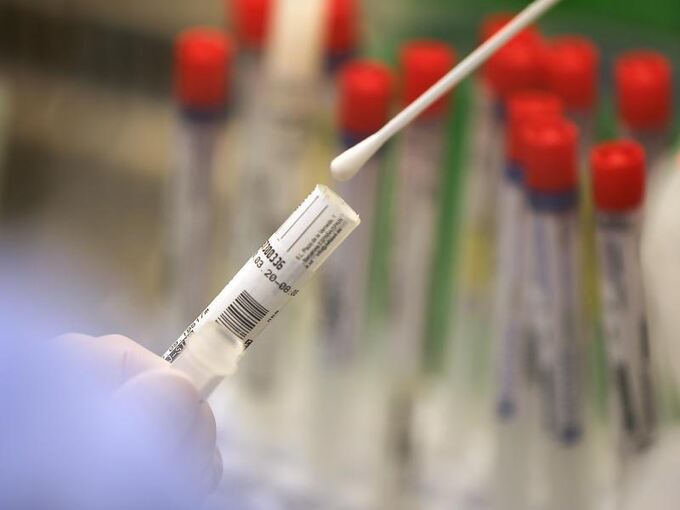 Ein Abstrich wird in einem Labor auf das Coronavirus untersucht