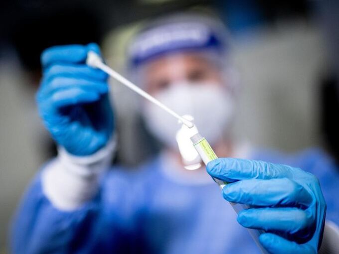 Coronavirus -Tests weiter kostenlos?