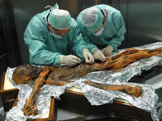 Ötzi