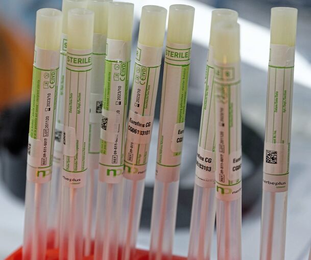 PCR-Tests sind nötig, um eine Coronainfektion zweifelsfrei nachzuweisen. Foto: Henning Kaiser/dpa
