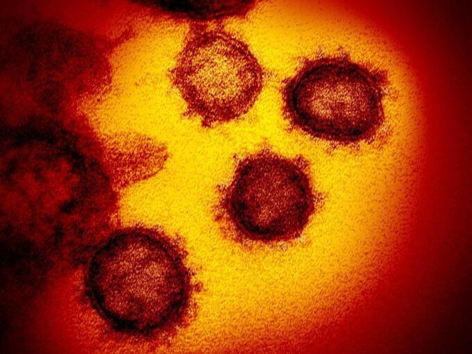 Coronavirus SARS-CoV-2