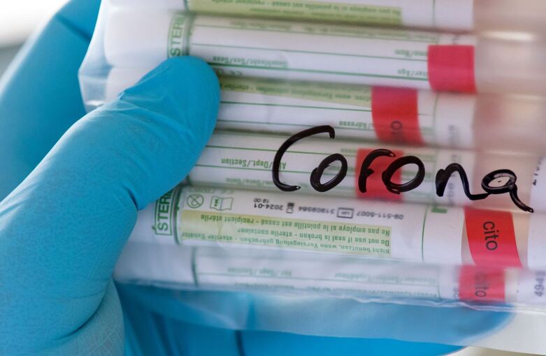 Corona-Tests