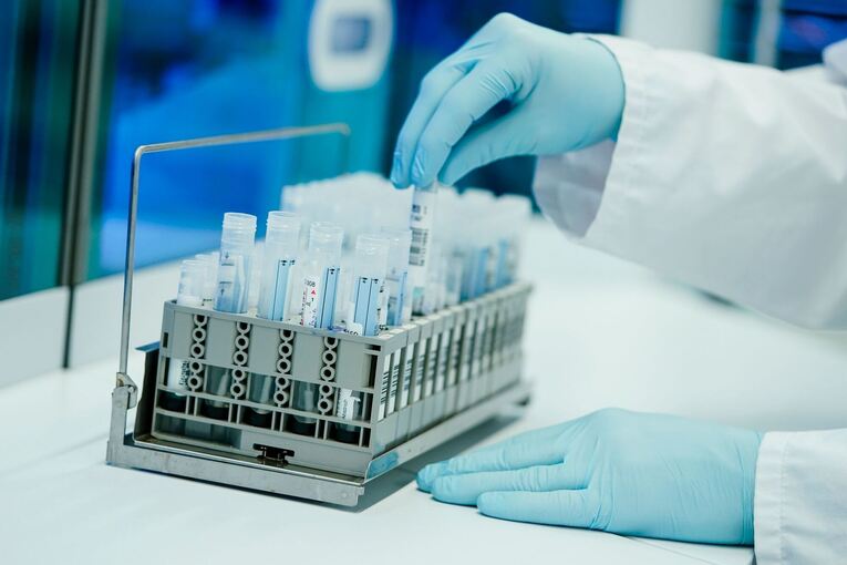 PCR-Teströhrchen