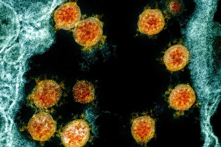 Coronavirus - Mikroskopische Aufnahme