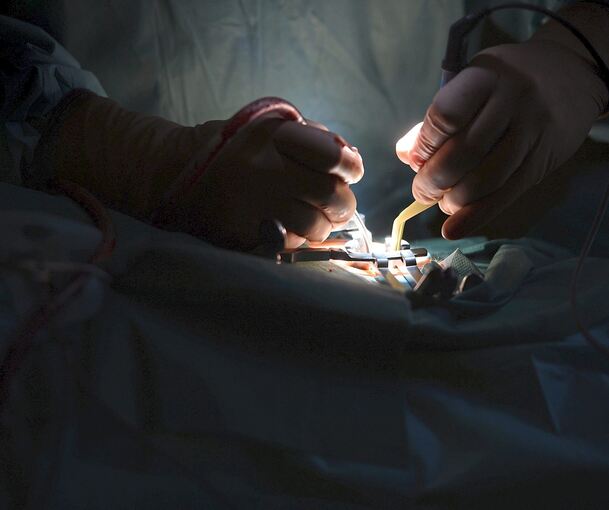 Ein Mediziner operiert an der Wirbelsäule. Foto: dpa