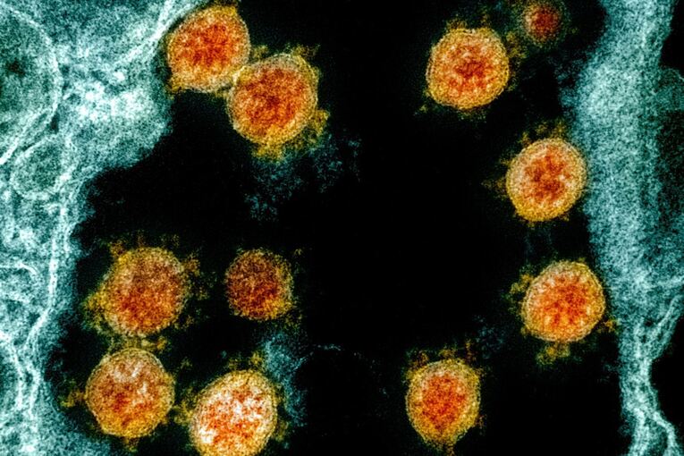 Coronavirus