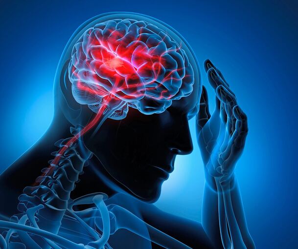 Bei einem Schlaganfall kommt es im Gehirn zu einem Verschluss oder zu einer gefährlichen Blutung.