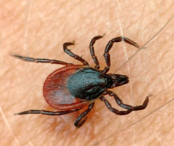 Eine Zecke krabbelt auf der Haut eines Mannes. Das Spinnentier kann gefährliche Krankheiten übertragen.