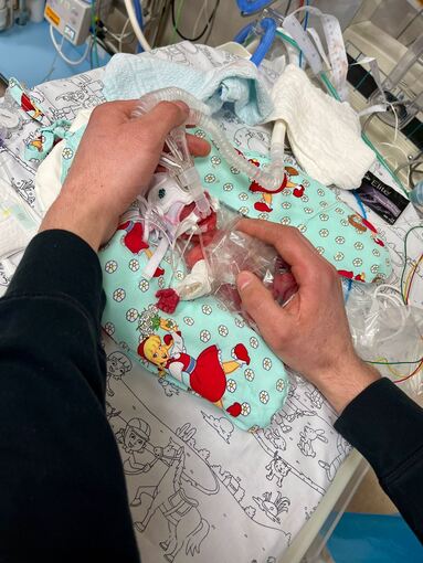 Frühgeborenes Mädchen mit 265 Gramm in Passau zur Welt gekommen