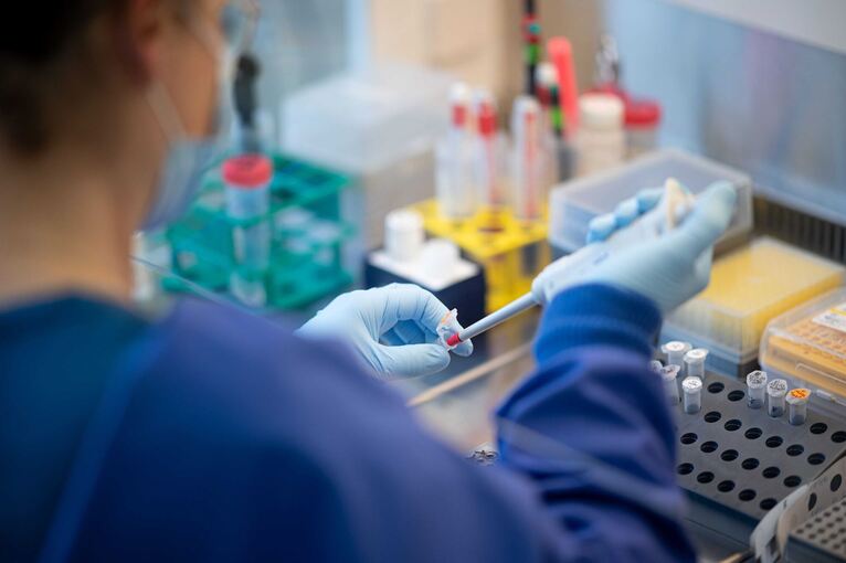 Monitoring von SARS-CoV-2 im Abwasser