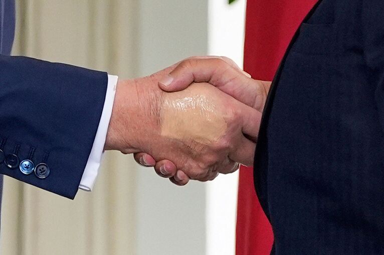 Weißes Haus: Trump hat chronisch venöse Insuffizienz