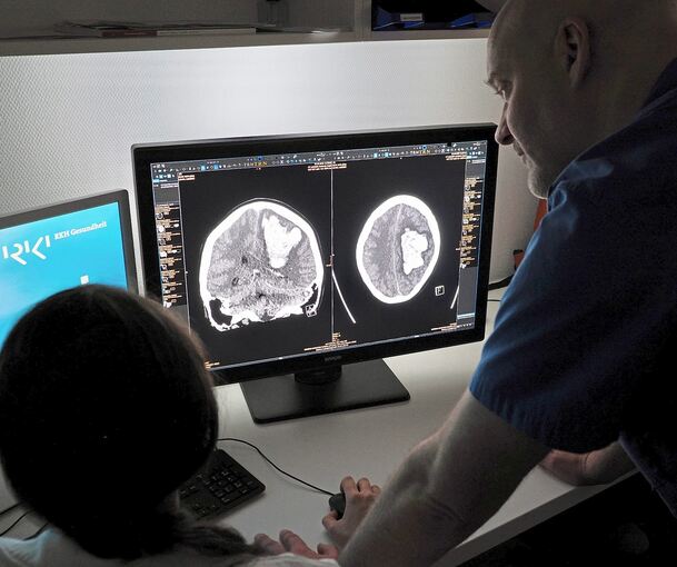 So sieht ein Schlaganfall im Gehirn aus: Auf dem CT-Scan erkennen die Ärzte eine starke Hirnblutung, die auf das umliegende Hirngewebe drückt.