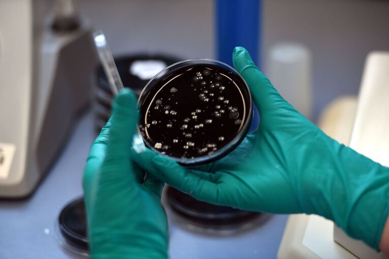 Legionellen Legionellen