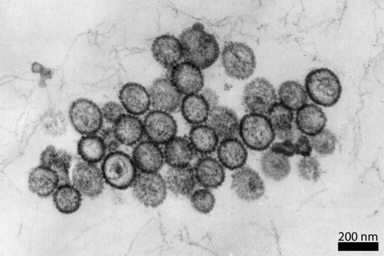 Hantavirus Hantavirus