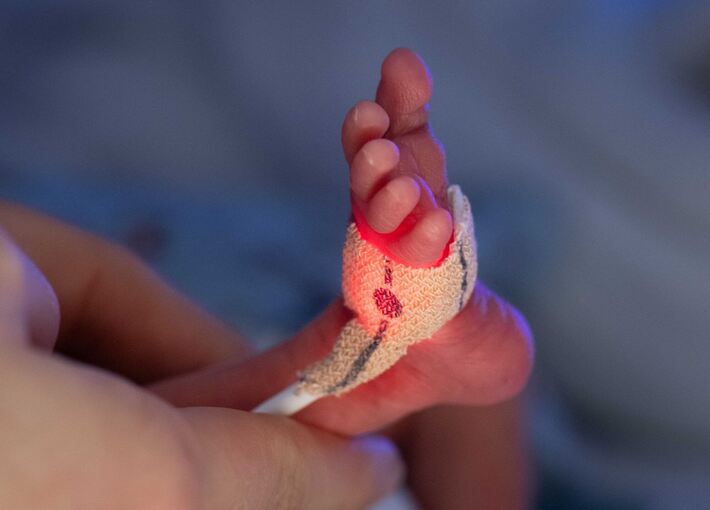 Darmkeim-Infektionen in Kinderklinik: Frühchen gestorben